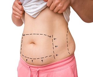 best belly fat removal