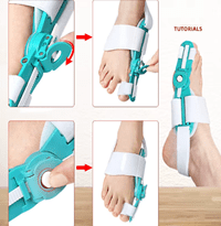 Hallux Valgus Corrector